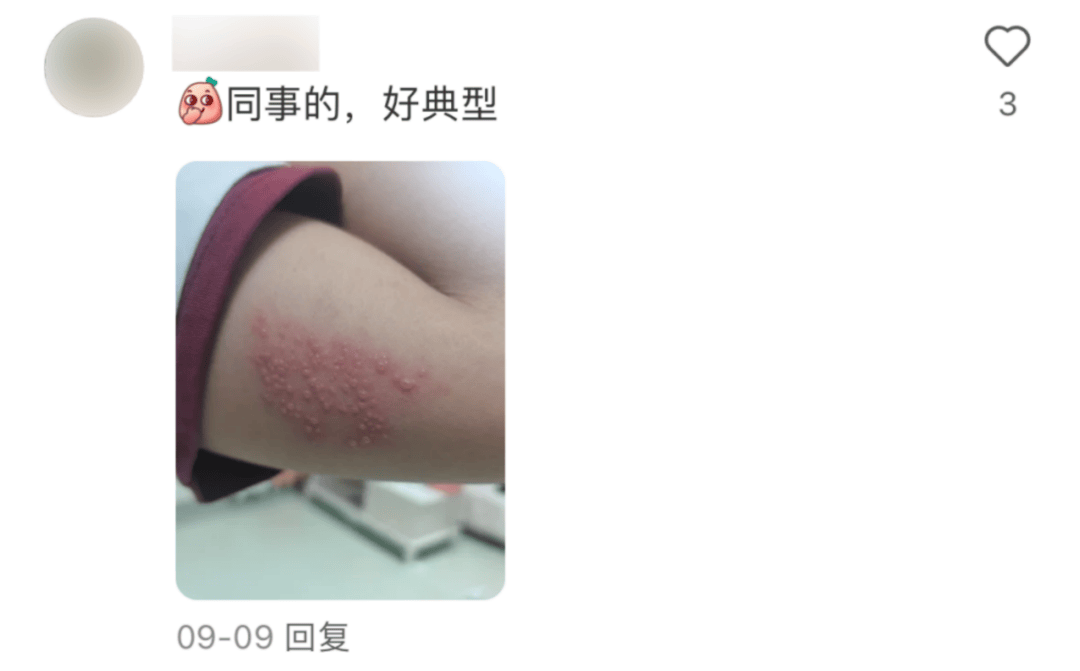 皇冠信用网登2代理_一旦感染终身携带皇冠信用网登2代理!深圳疾控提醒:这4类人要注意