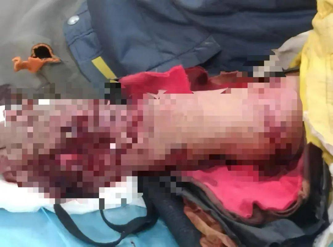 皇冠信用登2代理网址_老虎扑咬 73 岁老人撞到铁栅栏皇冠信用登2代理网址,家属:老虎咬人后欲闯我家