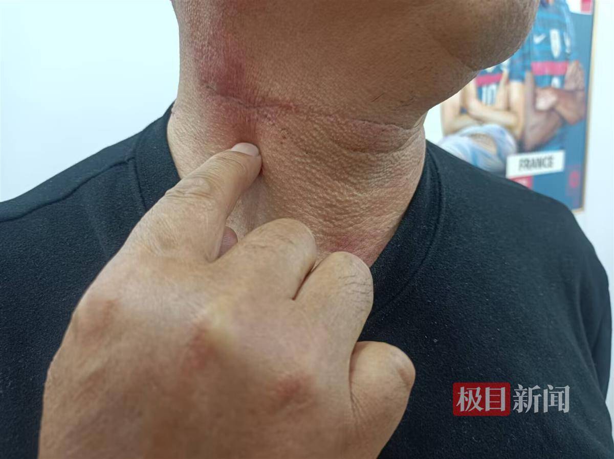 反恐精英2: PGL GLOBAL TOURNAMENT(3场2胜)_病房悲剧之谜：男子住院当晚捅伤同病房父子并跳楼身亡反恐精英2: PGL GLOBAL TOURNAMENT(3场2胜)，医院称其入院时无精神异常表现