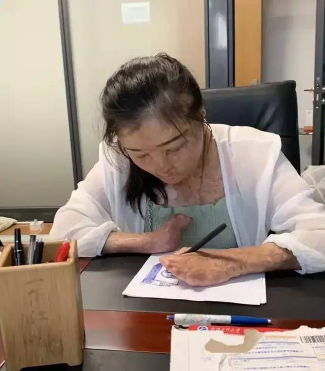 足球平台系统出租_全身95%烧伤女孩订婚了足球平台系统出租，与未婚夫同年同月同日生，本人发声：请大家祝福我们吧