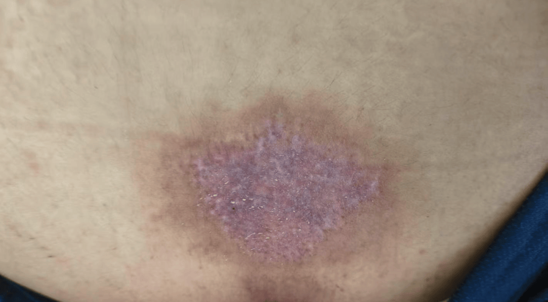 皇冠角球_14岁女孩在拓展营遭体罚去世皇冠角球，班主任因截留其给父母信件受审