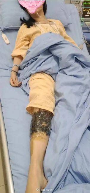 新2網址_女子在云南被银环蛇咬伤打了十多支血清新2網址,自称2年后仍有后遗症:头晕脸麻,没想到恢复得这么慢