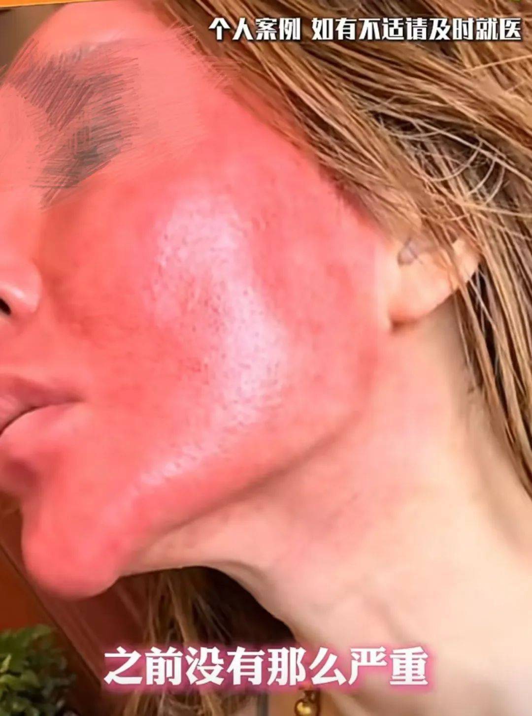 巴黎圣日耳曼vs迈阿密国际_太吓人！女子化妆20年没有卸妆巴黎圣日耳曼vs迈阿密国际，脸竟然变这样！网友：她怎么能忍住