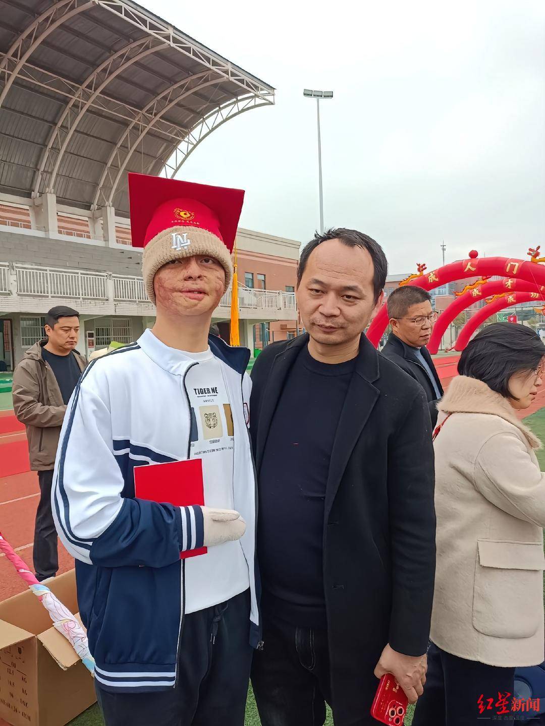 皇冠球網怎么做代理_“烧伤男孩”高考664分被东南大学录取：曾经历23次手术皇冠球網怎么做代理，计划未来读研读博