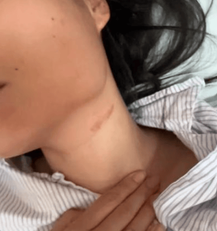 皇冠信用网最高占成_太猖狂了皇冠信用网最高占成，女子与面试官争辩后，被骗至厕所遭殴打，堪比黑势力