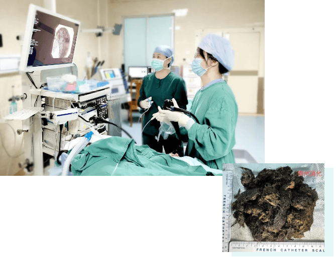 苏格兰超级联赛_发现1例苏格兰超级联赛，15岁女孩确诊！