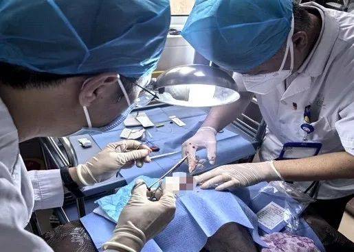 捷克甲组联赛 _太突然！上海98岁阿婆拿起剪刀捷克甲组联赛 ，一把剪掉头上的“角”！网友：对自己够狠