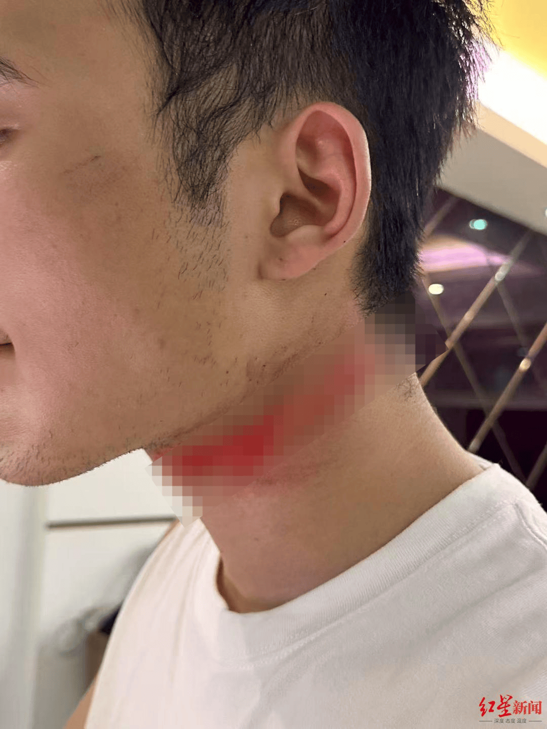 皇冠信用網APP下载_男主播骑车载女友回家被路边掉落网线勒伤脖子皇冠信用網APP下载，索赔3万陷僵局 律师解读该谁赔