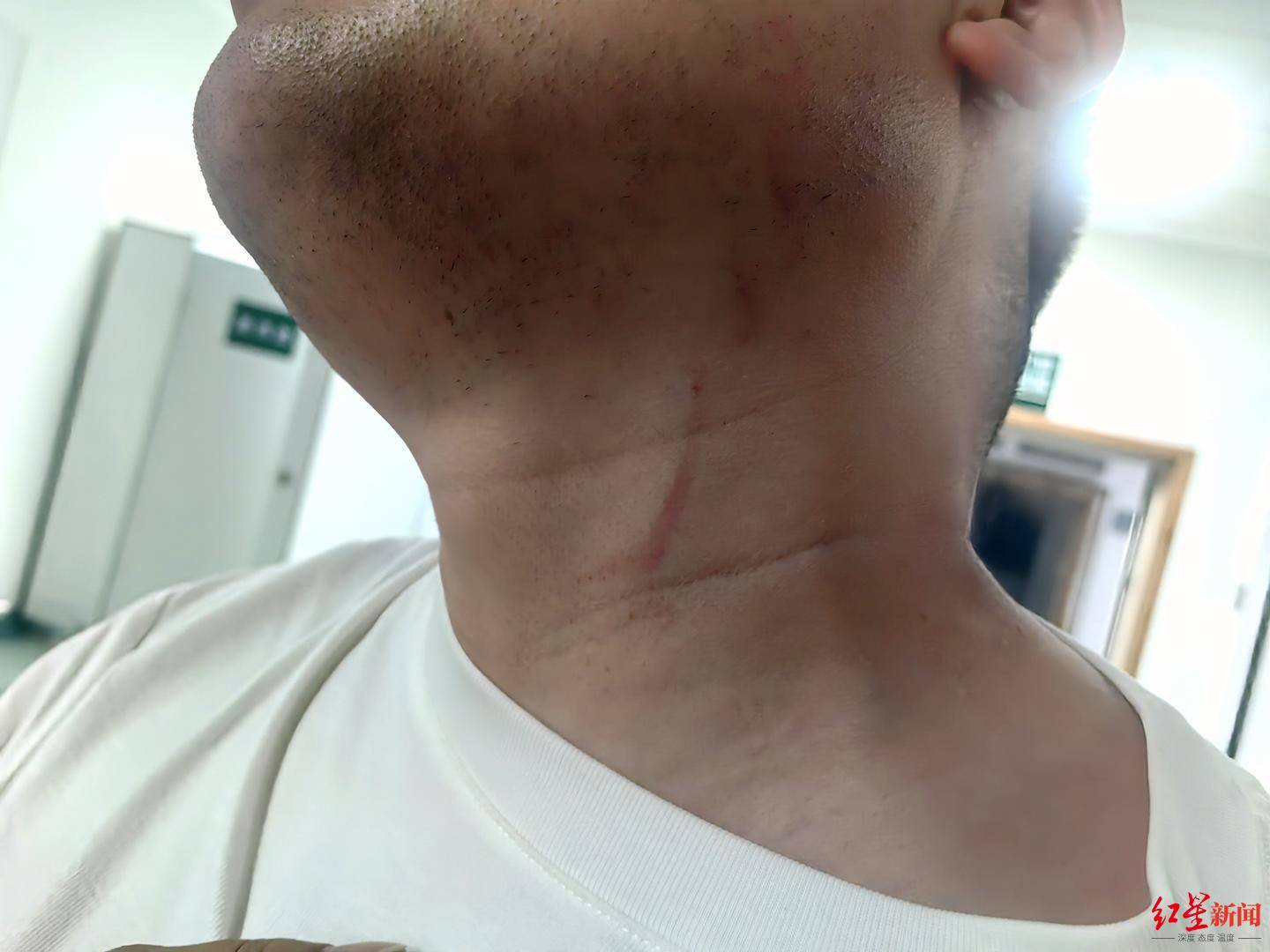 信用平台出租_武汉男子拍摄违停时被当街殴打信用平台出租，打人者被罚款500元，被打者称将提起行政复议并起诉