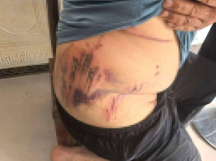 皇冠信用网占成代理_湖北鹤峰县疑再现老虎踪迹皇冠信用网占成代理,村民家猪遭袭,玉米地发现脚印,此前男子自称干农活时被抓伤,当地回应