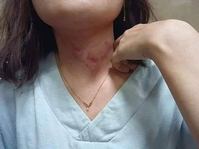 皇冠信用网平台出租_一男子凌晨听到两声呼救皇冠信用网平台出租，循声发现一女子在奔驰车外被白衣男勒昏！受害者：是受朋友之托借钱给白衣男，凌晨被骗至偏僻处遭非礼！